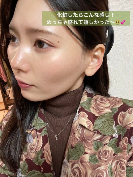 テラ・コートリル 軟膏(医薬品)/ジョンソン・エンド・ジョンソン/その他を使ったクチコミ(7枚目)