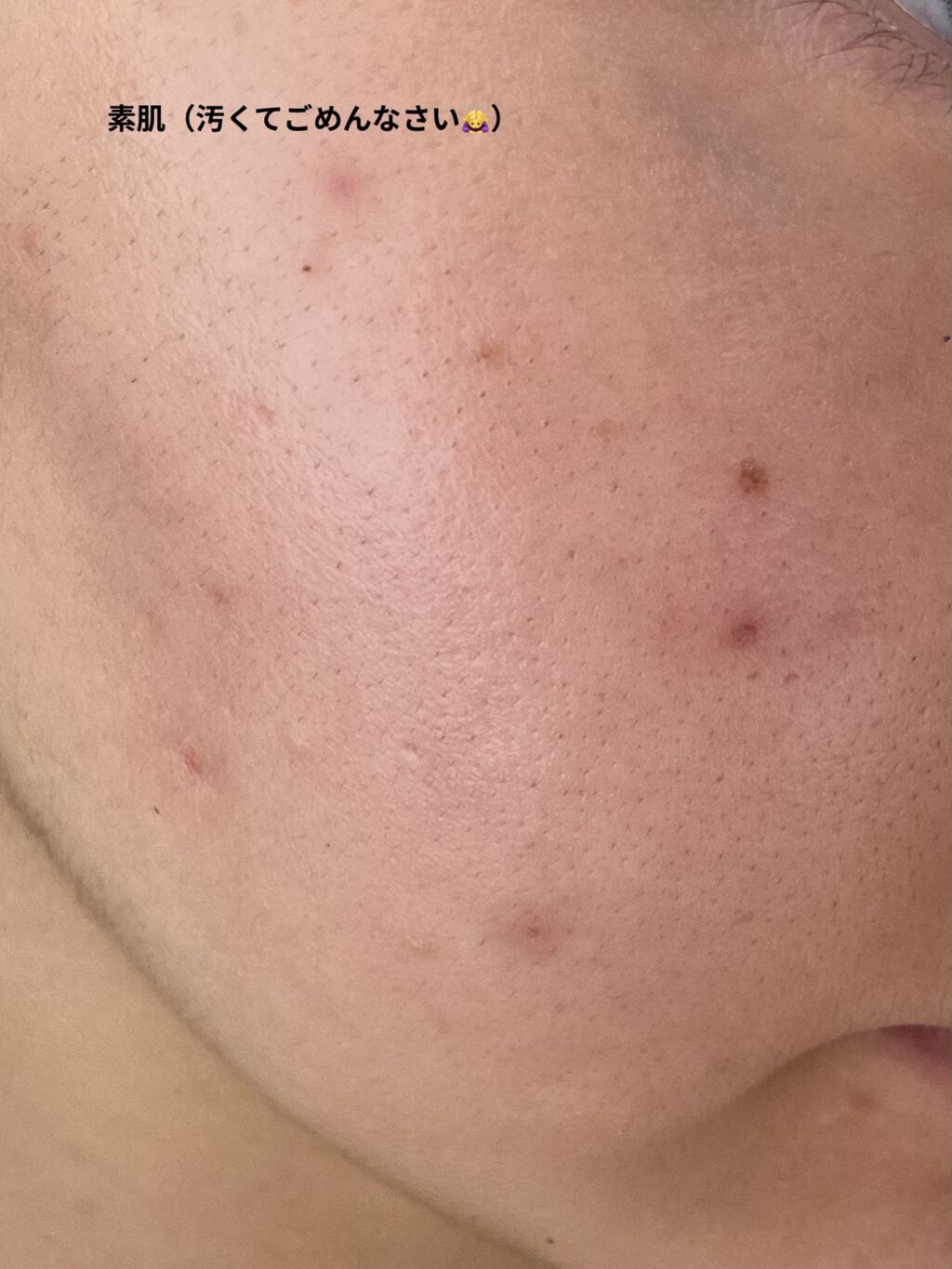 フィットミー リキッドファンデーション R/MAYBELLINE NEW YORK/リキッドファンデーションを使ったクチコミ（3枚目）