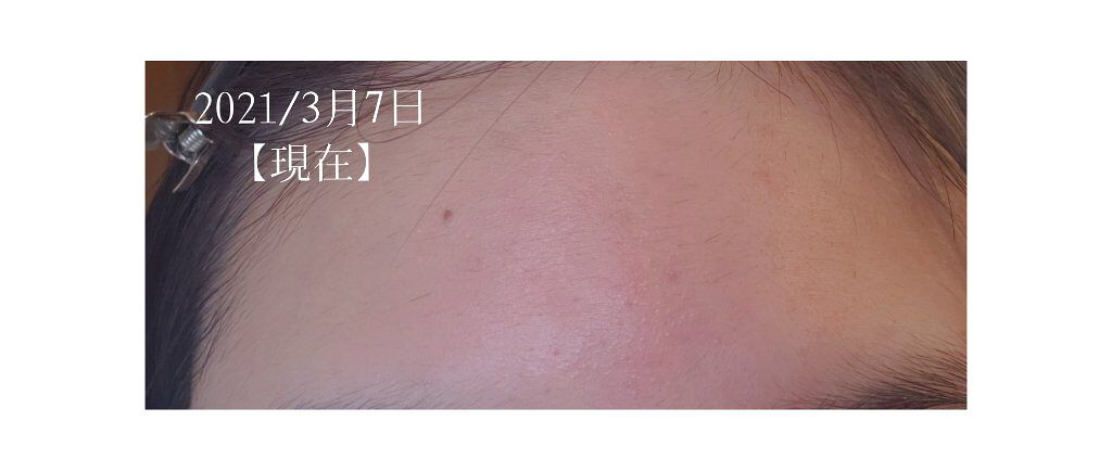 明色美顔水 薬用化粧水/美顔/化粧水を使ったクチコミ(4枚目)