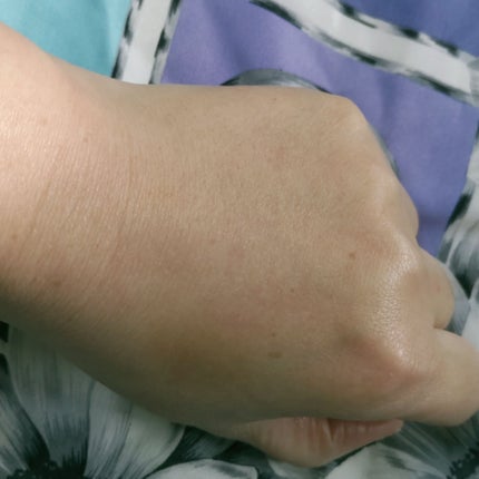 アトデルム インテンシブクリーム/ビオデルマ/フェイスクリームを使ったクチコミ(8枚目)