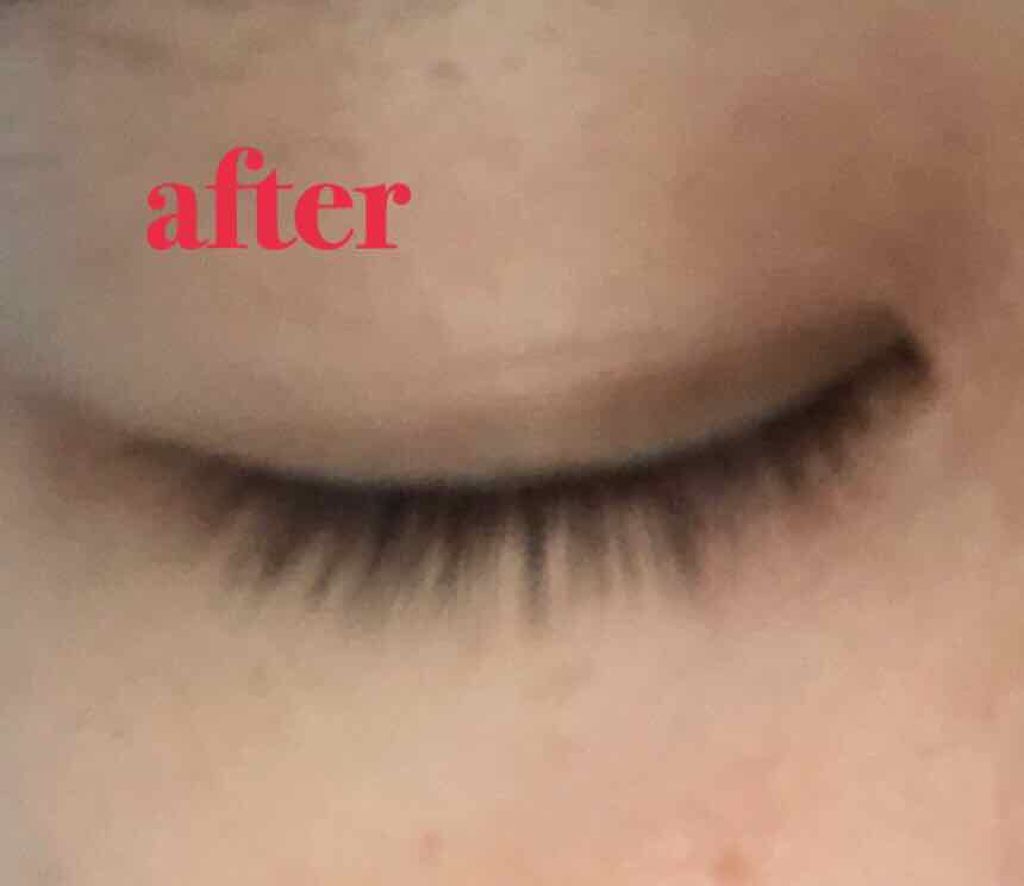 ローヤルゼリー配合 栄養ローション/DAISO/美容液を使ったクチコミ(3枚目)