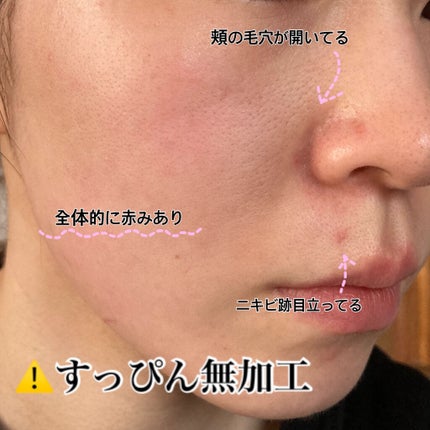 ナチュラルラディアント ロングウェア クッションファンデーション/NARS/クッションファンデーションを使ったクチコミ(2枚目)