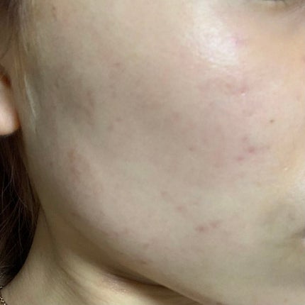 を使ったクチコミ(2枚目)