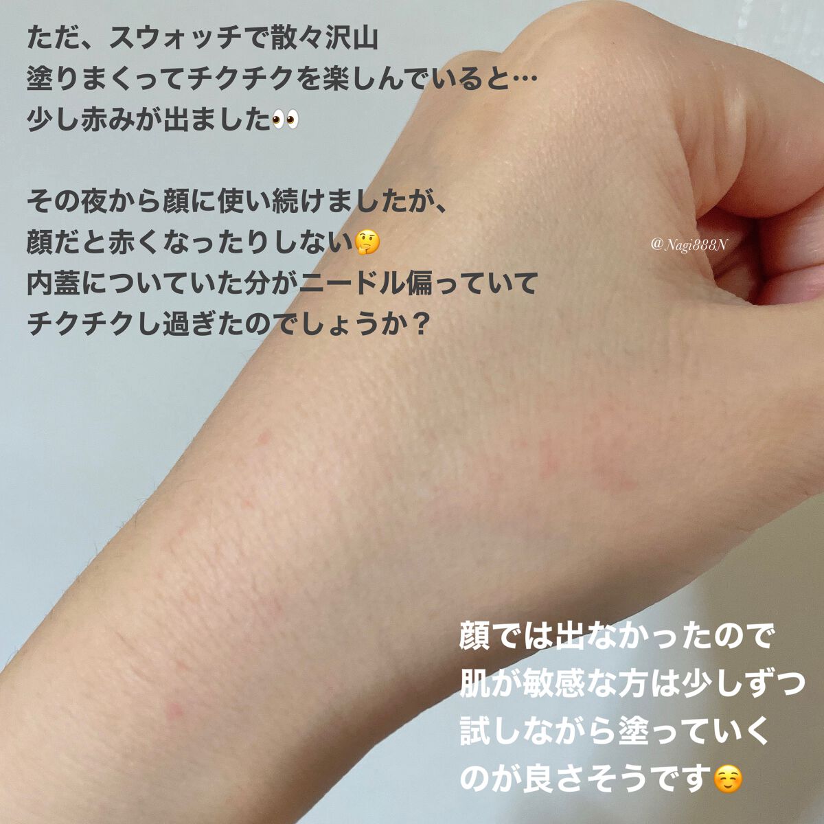 メディリフト ニードルリフトクリーム/YA-MAN TOKYO JAPAN/フェイスクリームを使ったクチコミ(6枚目)