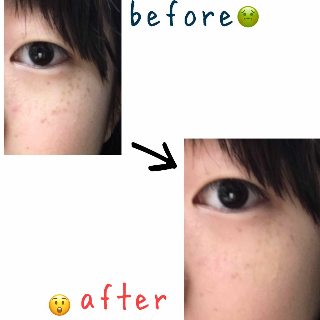 マジックコンシーラー/カリプソ/リキッドコンシーラーを使ったクチコミ（2枚目）