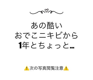 白潤プレミアム薬用浸透美白化粧水/肌ラボ/化粧水を使ったクチコミ（1枚目）