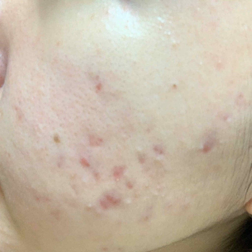 ドクタージャルト シカペア クリーム (第2世代)/Dr.Jart+/フェイスクリームを使ったクチコミ(3枚目)