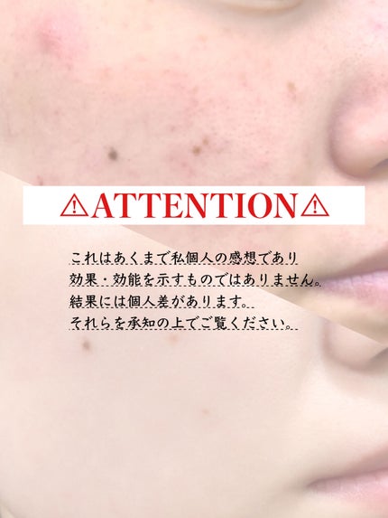 ハトムギ保湿ジェル(ナチュリエ スキンコンディショニングジェル)/ナチュリエ/美容液を使ったクチコミ(3枚目)