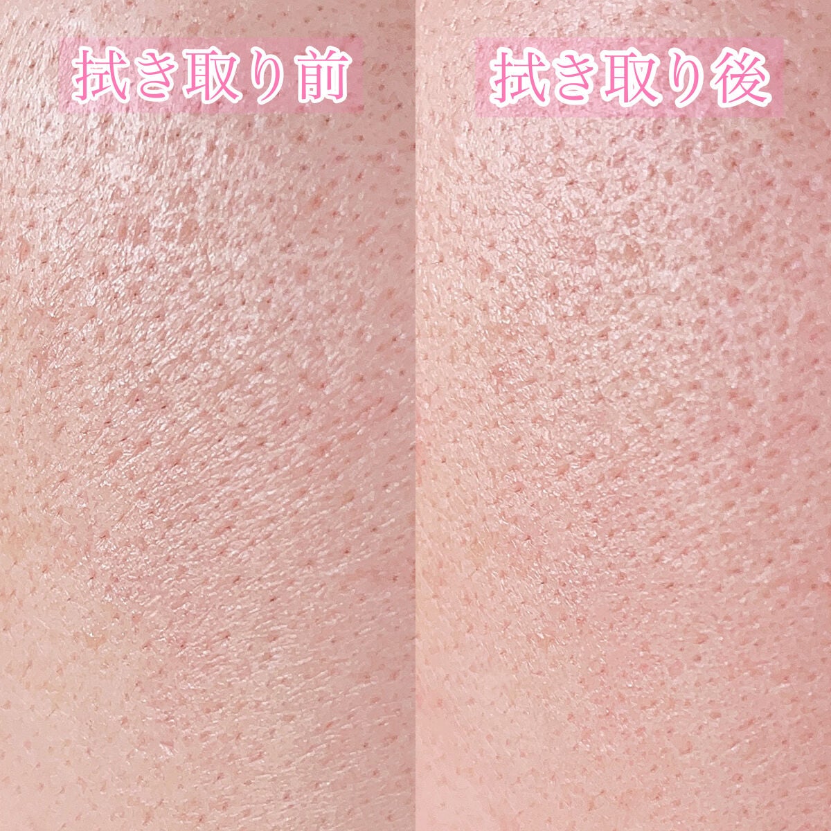 オイデルミン(N)/SHISEIDO/化粧水を使ったクチコミ(5枚目)