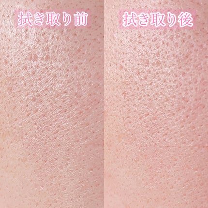 オイデルミン(N)/SHISEIDO/化粧水を使ったクチコミ(5枚目)