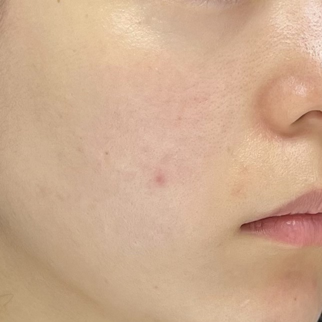 ヴィーガンリポソームレチノールセラム/SKIN&LAB/美容液を使ったクチコミ（2枚目）