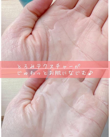 薬用マイクロバブルローション/Macchia Label/化粧水を使ったクチコミ(3枚目)