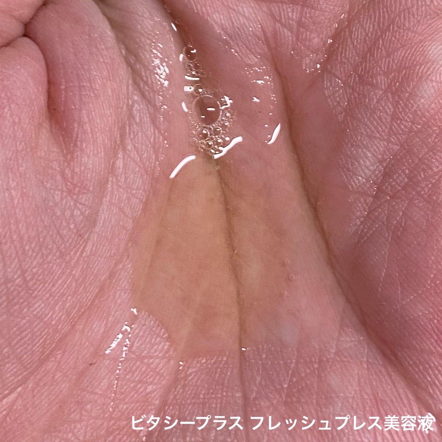 ミシャ ビタシープラス 美容液【日本処方】/MISSHA/美容液を使ったクチコミ(2枚目)