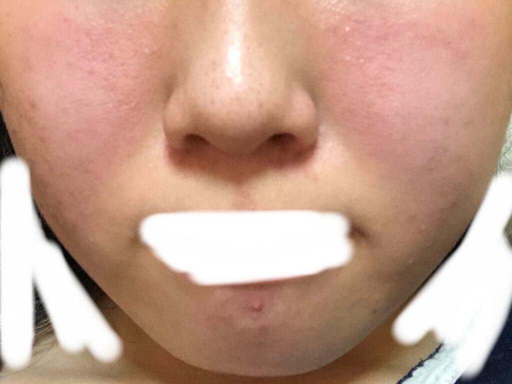 ハトムギ化粧水(ナチュリエ スキンコンディショナー R )/ナチュリエ/化粧水を使ったクチコミ(2枚目)