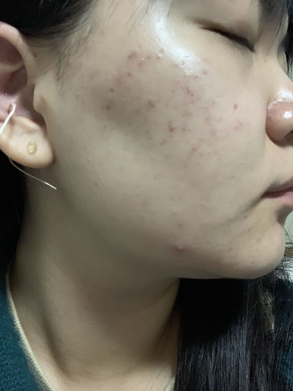 ティーツリーケア ソリューション エッセンシャルマスクEX/MEDIHEAL/シートマスク・パックを使ったクチコミ（2枚目）