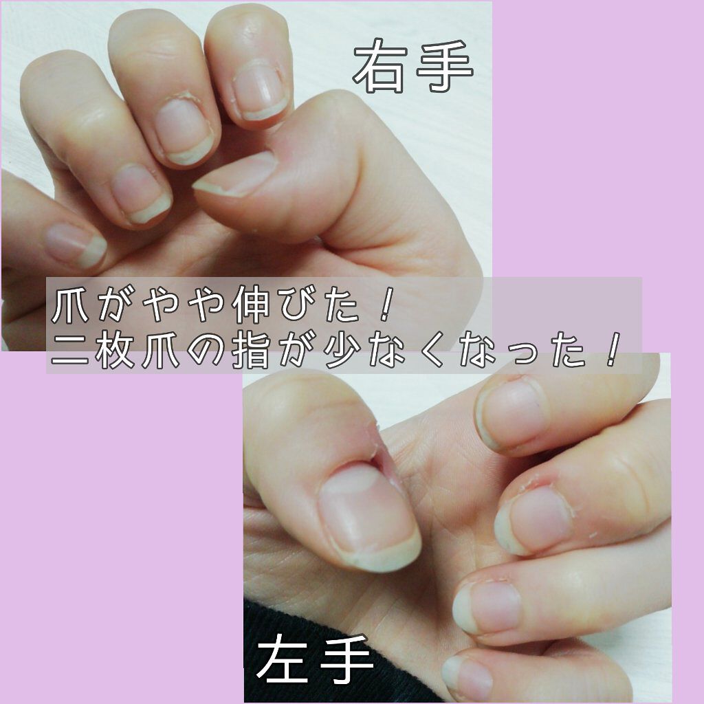 オリジナル ピュアスキンジェリー/ヴァセリン/ボディクリームを使ったクチコミ(3枚目)