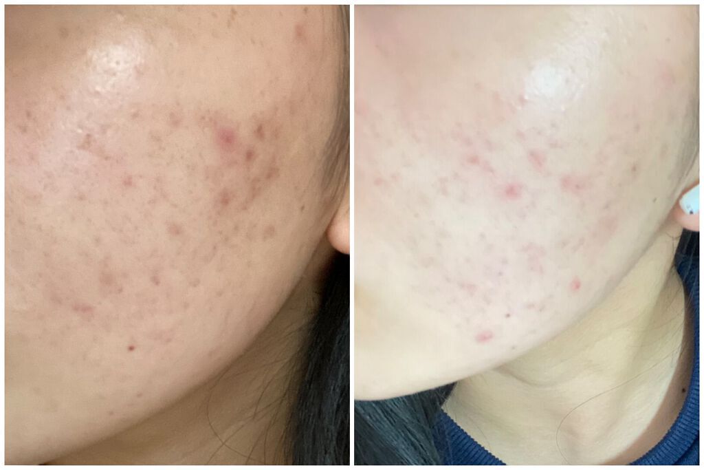 なっちゃん on LIPS 「デュアックの女でーす全然投稿してなかったー💦最近は全然デュアッ..」(4枚目)