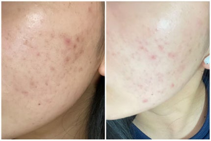 なっちゃん on LIPS 「デュアックの女でーす全然投稿してなかったー💦最近は全然デュアッ..」(4枚目)