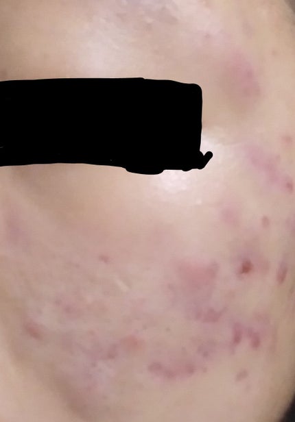 を使ったクチコミ(2枚目)