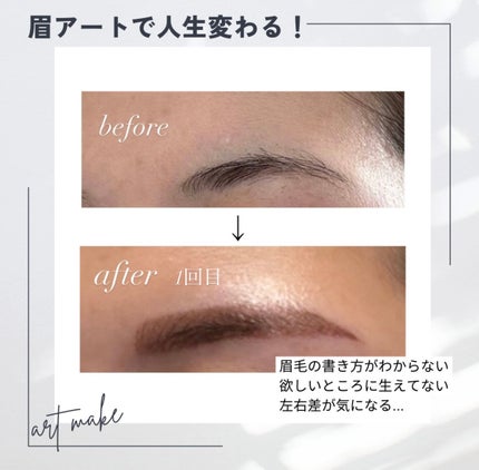 脱色クリーム スピーディー/エピラット/ムダ毛ケアを使ったクチコミ(1枚目)