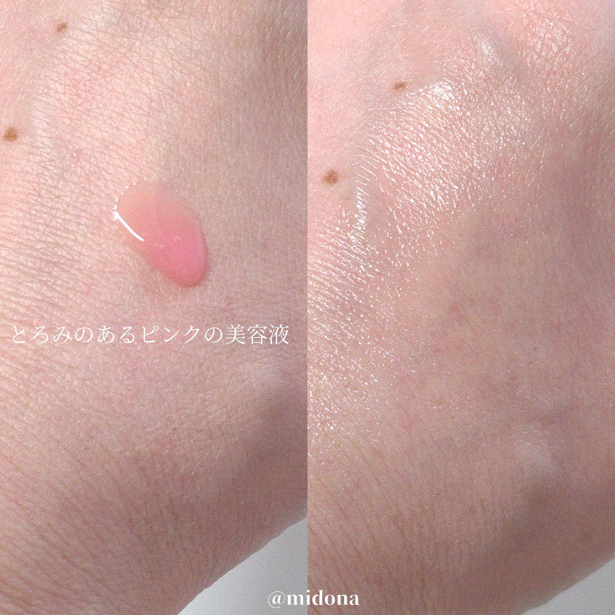 PDRNピンクアンプル PDRN 10,000ppm配合/MEDICUBE/美容液を使ったクチコミ（3枚目）