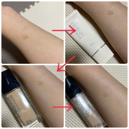 【旧】ディオールスキン フォーエヴァー フルイド グロウ/Dior/リキッドファンデーションを使ったクチコミ(2枚目)