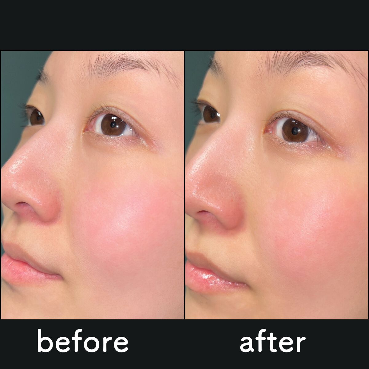 キメケア カバノアナタケバイオームアンプル/efilow/美容液を使ったクチコミ(5枚目)