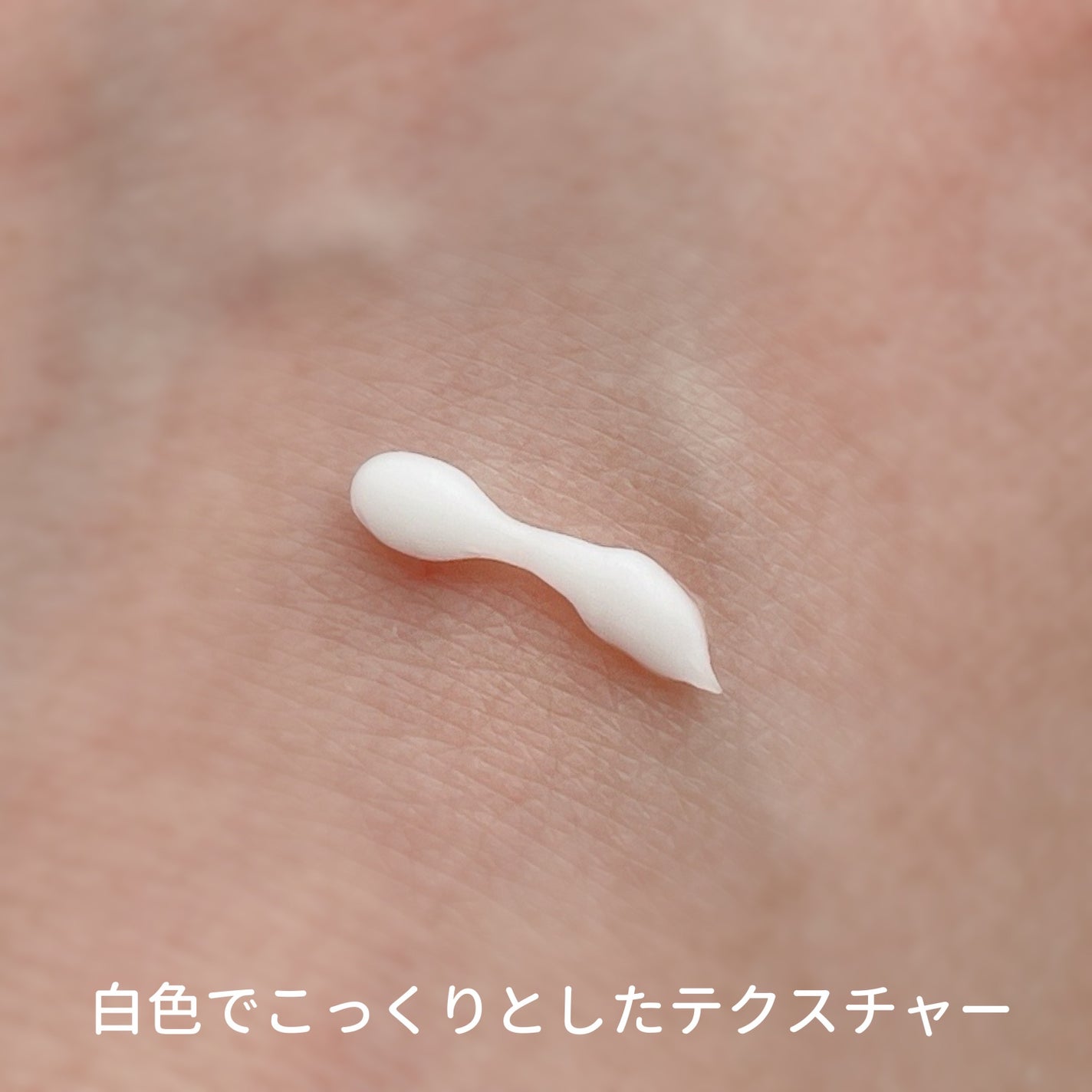 メディダーマ ニードルポアセラム800/メディダーマ/美容液を使ったクチコミ(5枚目)