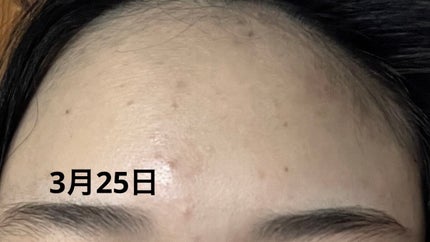 桃70%ナイアシンセラム/Anua/美容液を使ったクチコミ(2枚目)