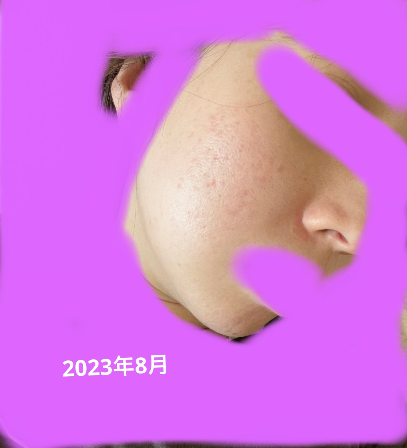 プリスクリードD(医薬品)/IHADA/その他を使ったクチコミ(4枚目)