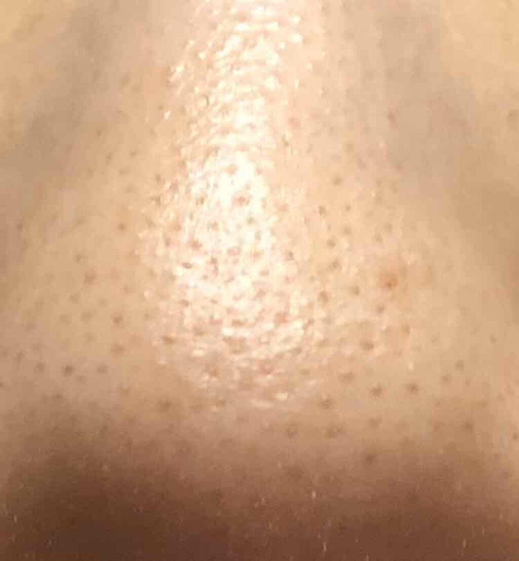 momo on LIPS 「鼻の毛穴について悩んでいます😭汚い写真をのせてる事をご了承くだ..」(2枚目)