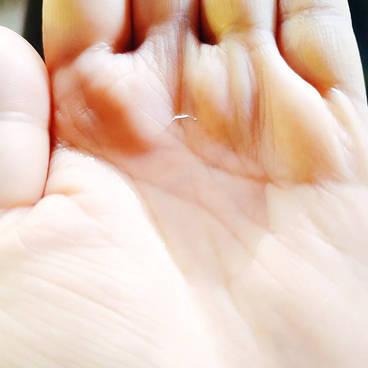 ピンクティーツリートナー/APLIN/化粧水を使ったクチコミ（3枚目）