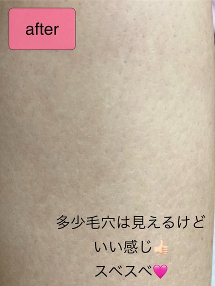 ヴィート ピュアバスタイム除毛クリーム 敏感肌用/Veet/除毛クリームを使ったクチコミ(6枚目)