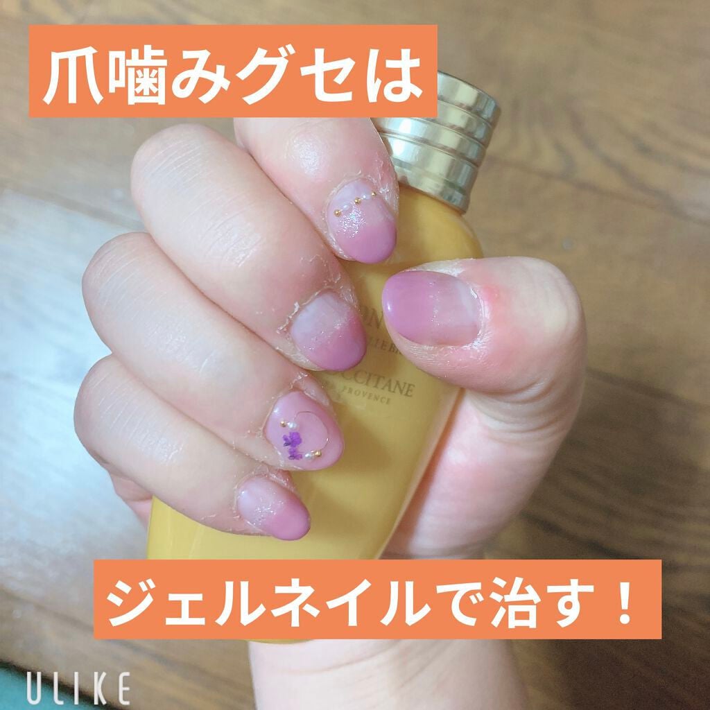 さ on LIPS 「深爪・チビ爪矯正日記🤞私自身ずっと爪を噛むクセがあって大学入っ..」(1枚目)