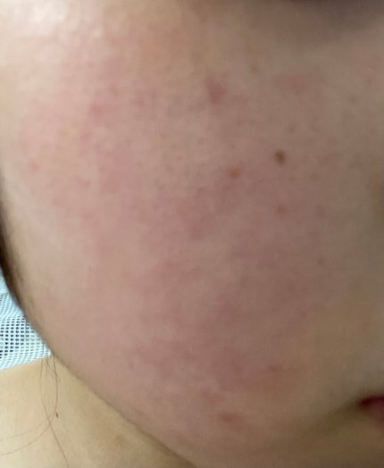 薬用しみ対策 美白化粧水/メラノCC/化粧水を使ったクチコミ(2枚目)