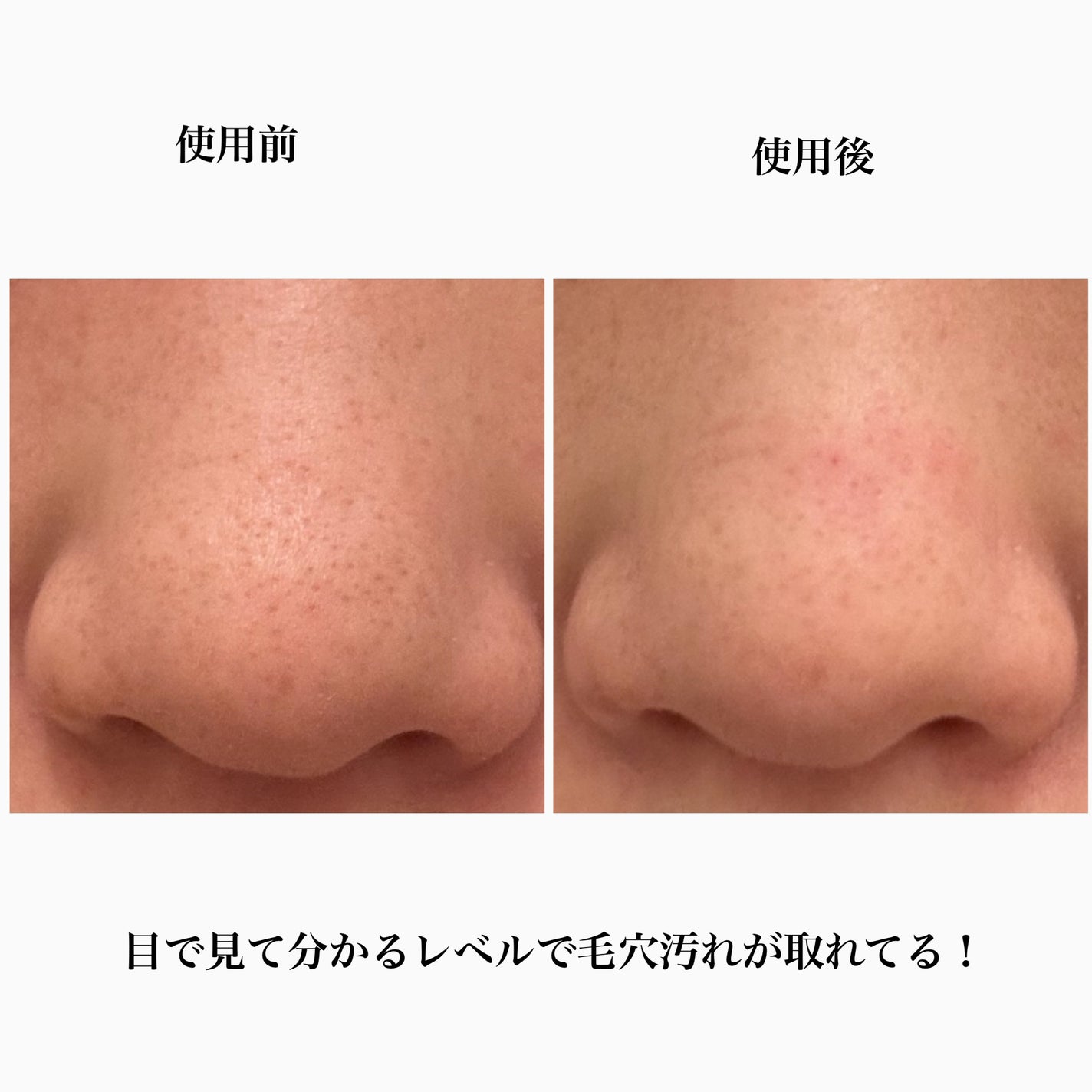 オバジC 酵素洗顔パウダーDP/オバジ/洗顔パウダーを使ったクチコミ(5枚目)