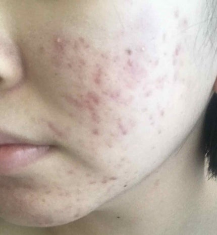 を使ったクチコミ(2枚目)