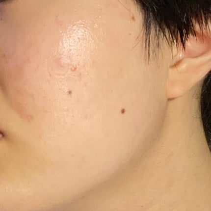 ピュアショット クリーム/YVES SAINT LAURENT BEAUTE/フェイスクリームを使ったクチコミ(3枚目)