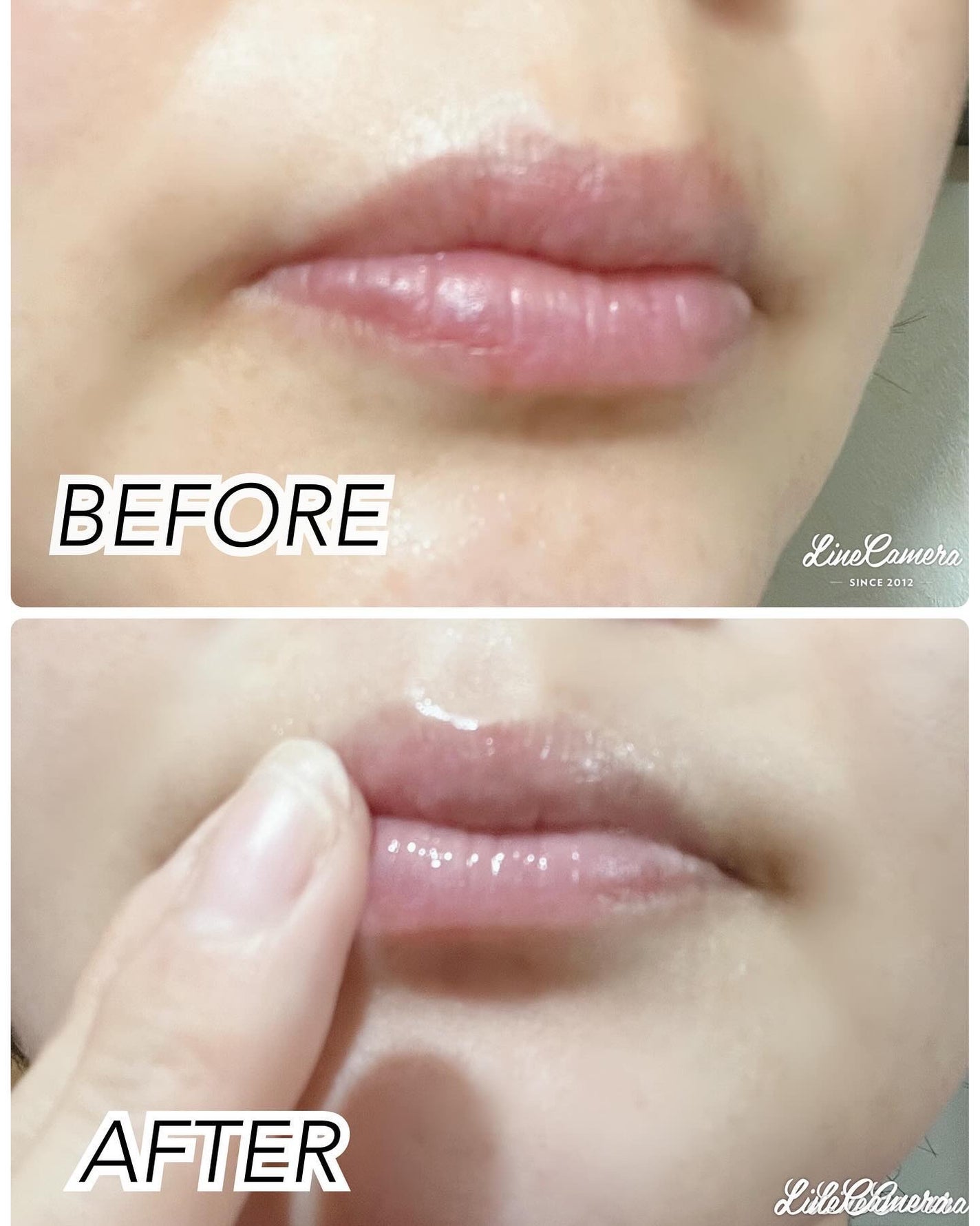 LIPS SHOT/MOTTO LAB./リップマスクを使ったクチコミ(4枚目)