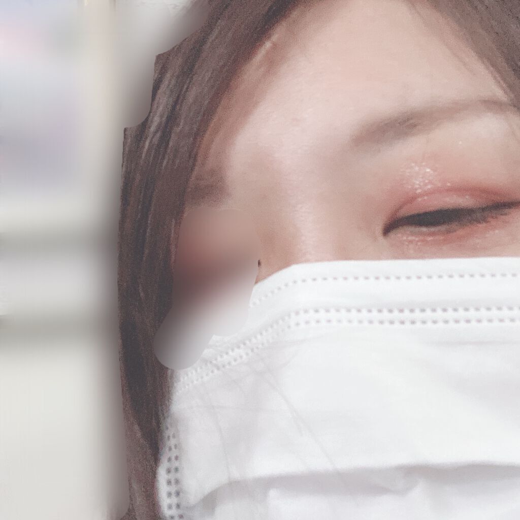 グロウフルールチークス/キャンメイク/パウダーチークを使ったクチコミ(4枚目)