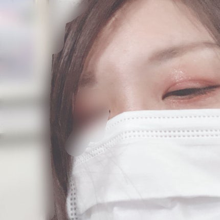 グロウフルールチークス/キャンメイク/パウダーチークを使ったクチコミ(4枚目)