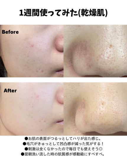 5GF リフティナル ターンオーバー 美容液/Mildlab/美容液を使ったクチコミ(4枚目)