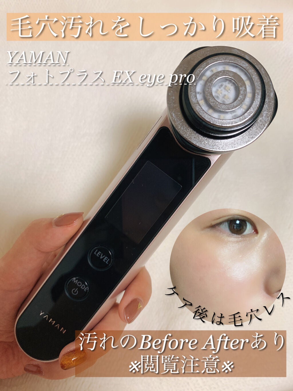 RF フォトプラスEX eye pro｜ヤーマンの効果に関する口コミ - \肌荒れ ...