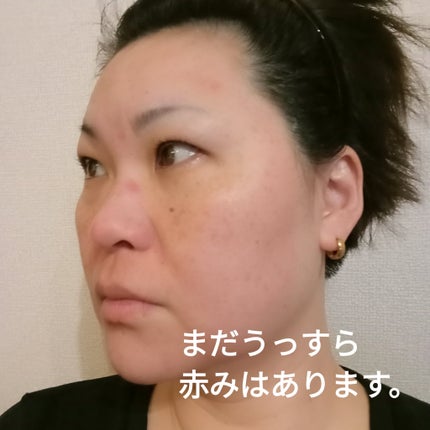 を使ったクチコミ(2枚目)