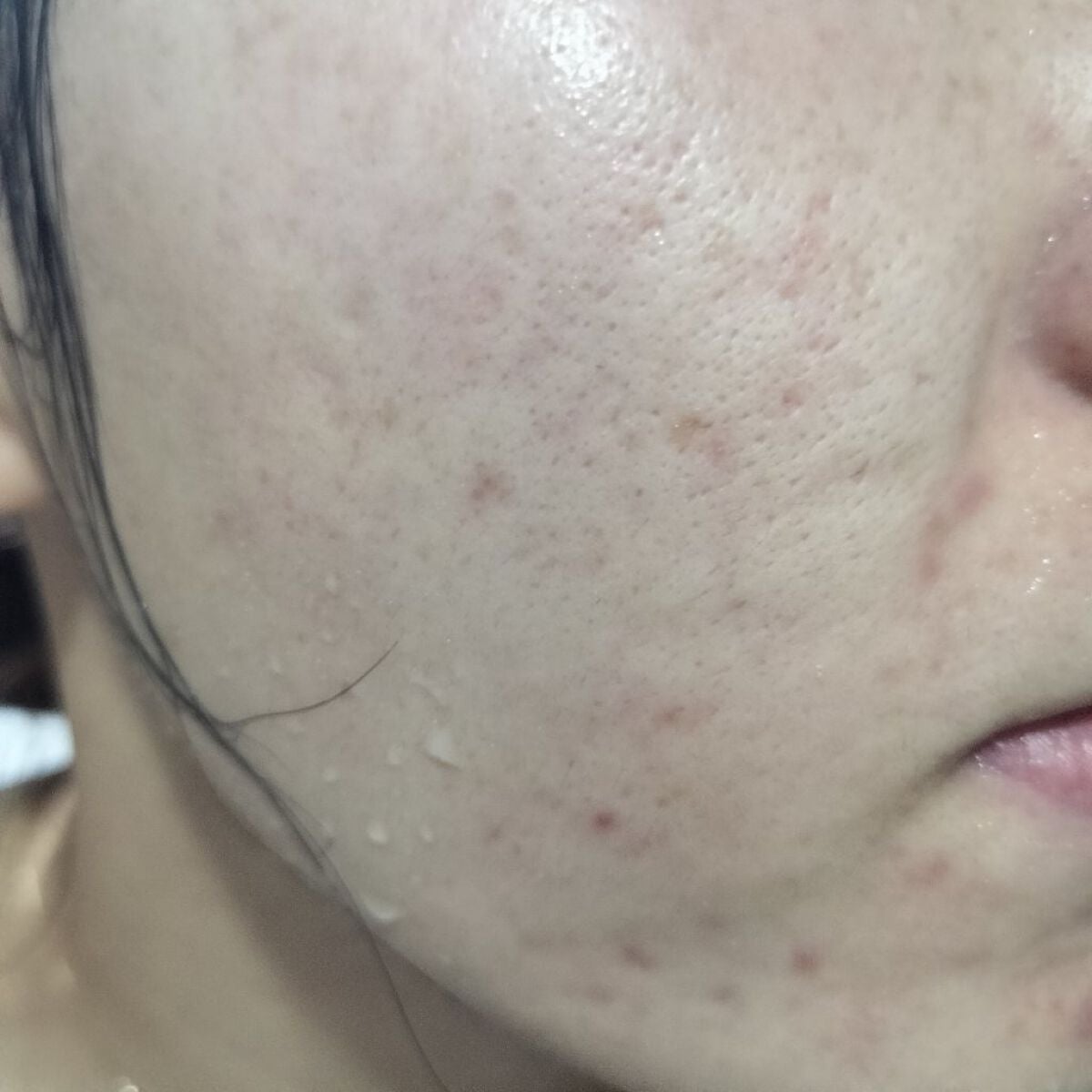 miina@汚肌工事録⚠️ on LIPS 「11/1の#汚肌工事録ありがとう❤今日もお疲れ様でした。/#毎..」(1枚目)