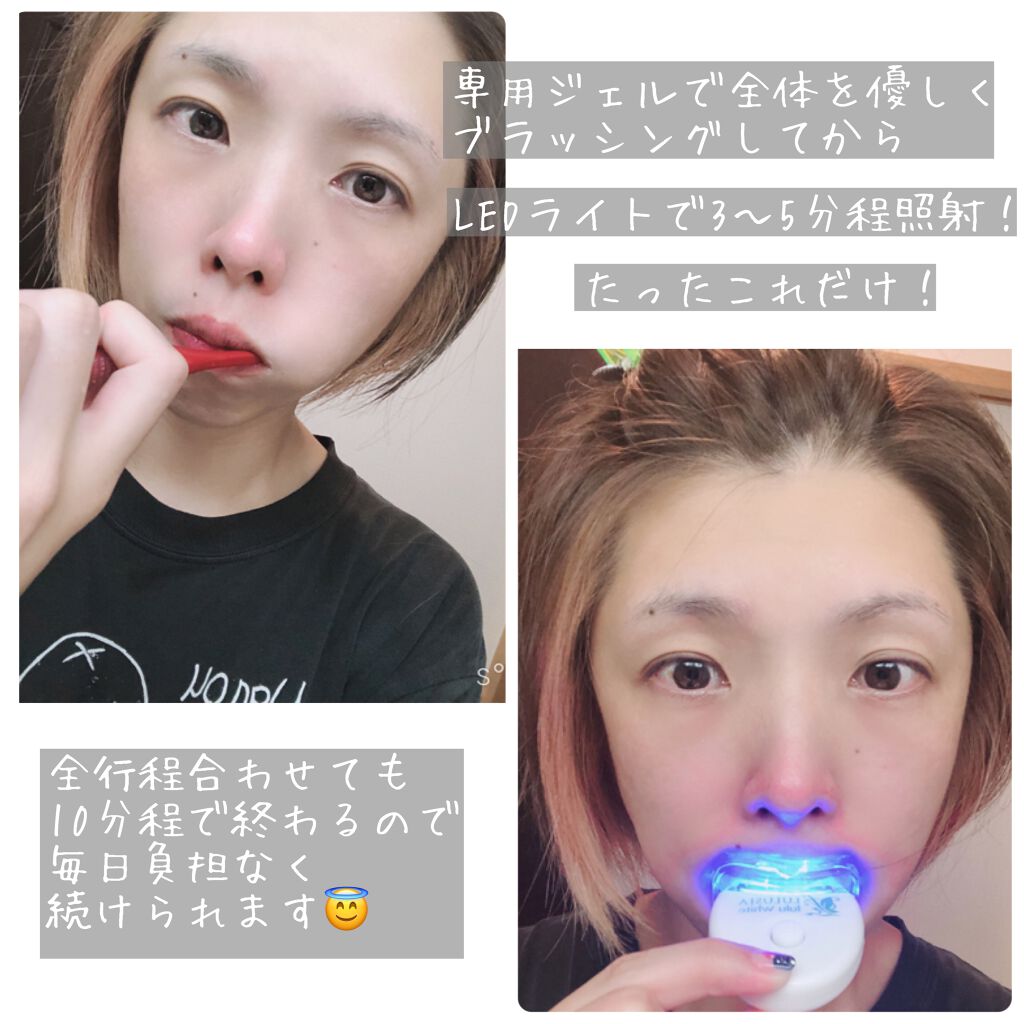 ルルホワイト/ルルシア/その他オーラルケアを使ったクチコミ(4枚目)