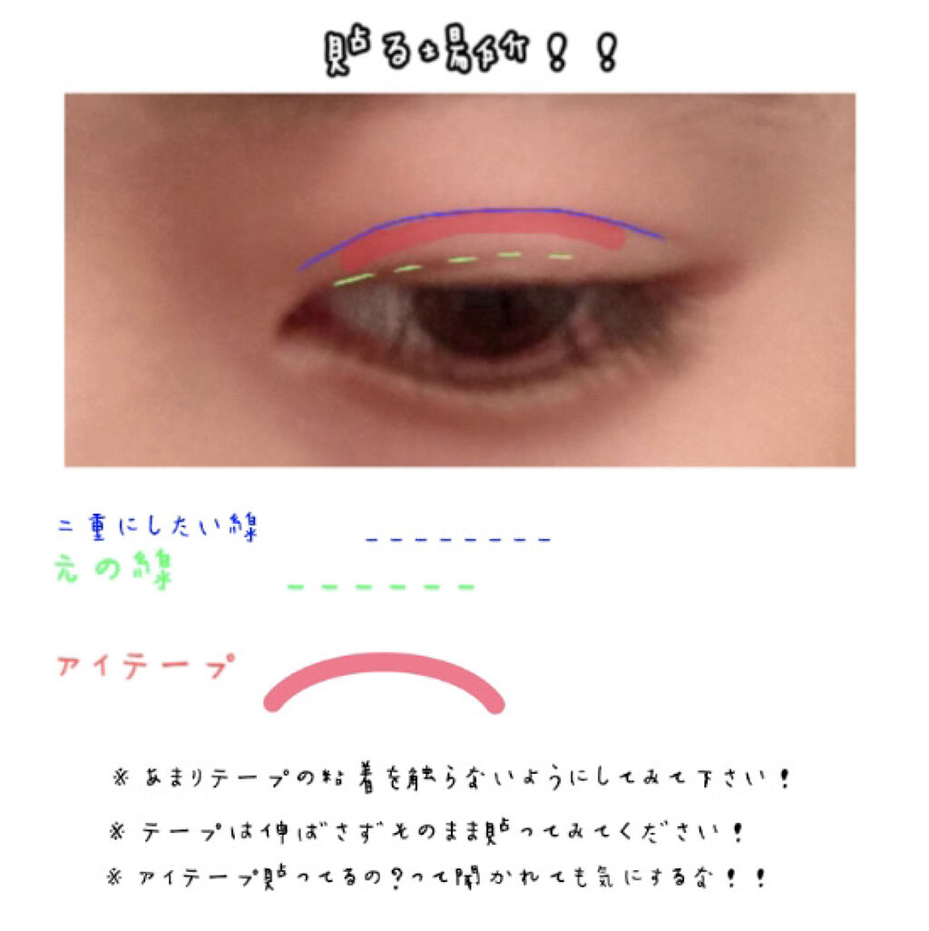 アイテープ 片面テープ ポイント のびーるタイプ ライトピンク/DAISO/二重まぶた用アイテムを使ったクチコミ（2枚目）