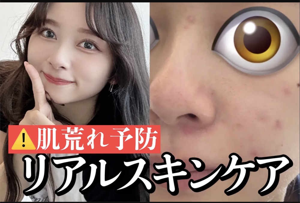 リンクルリペアモイスチャライザー/Neutrogena/乳液を使ったクチコミ（1枚目）