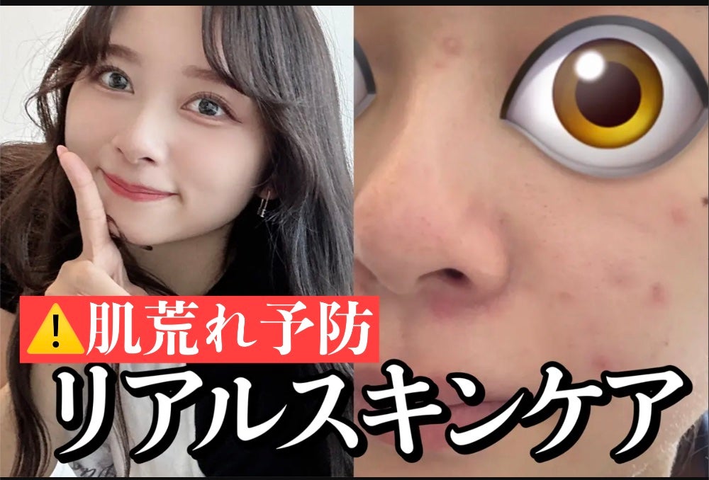 リンクルリペアモイスチャライザー/Neutrogena/乳液を使ったクチコミ(1枚目)