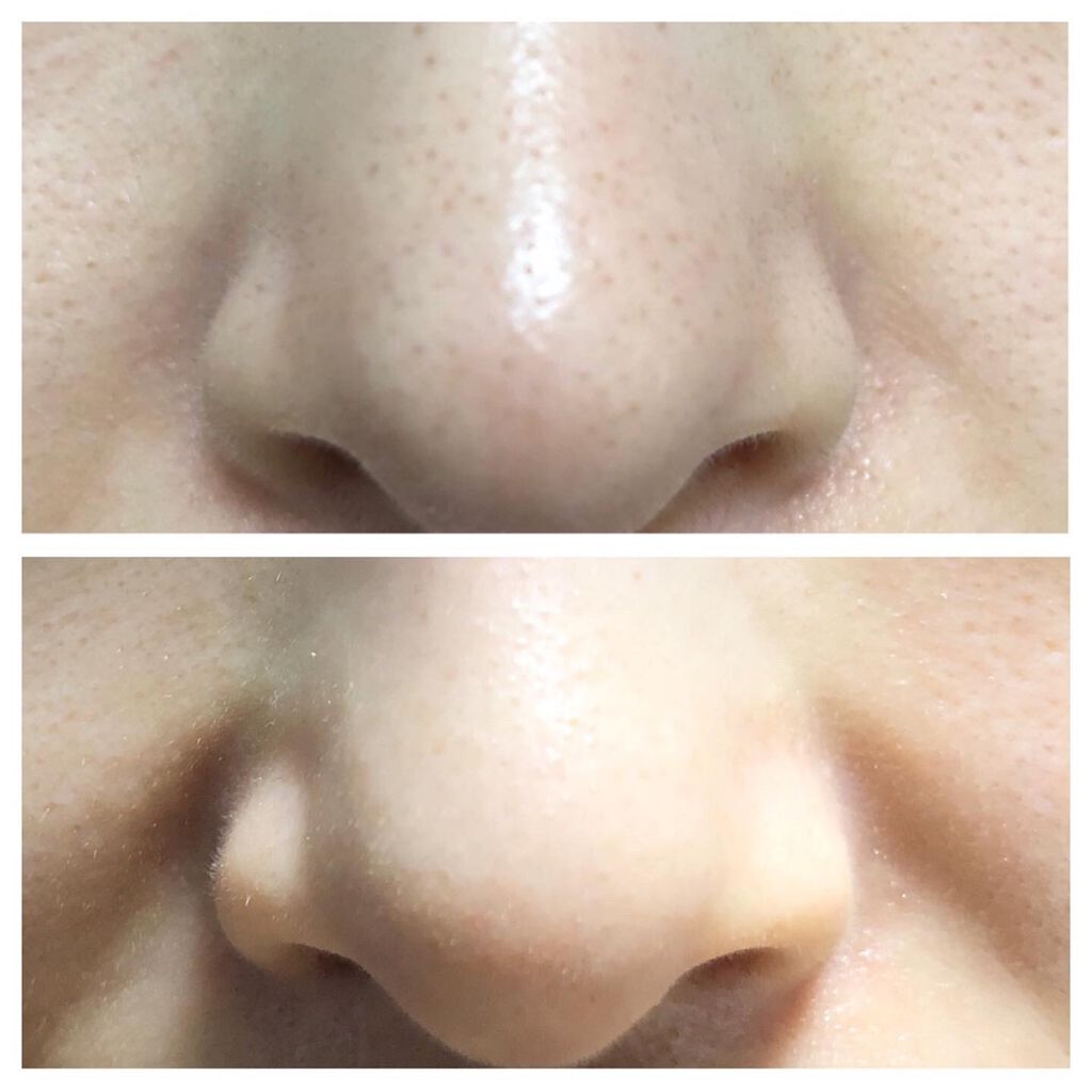 モッチスキン吸着泡洗顔FL(レモン)/MoccHi SKIN/泡洗顔を使ったクチコミ（3枚目）